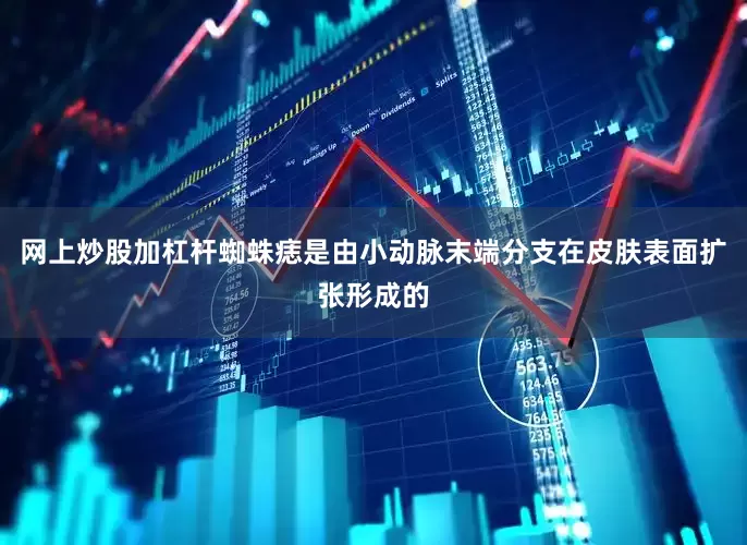网上炒股加杠杆蜘蛛痣是由小动脉末端分支在皮肤表面扩张形成的